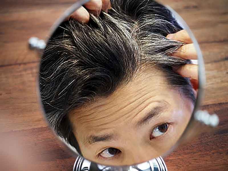  أنواع كريم علاج الشعر الأبيض